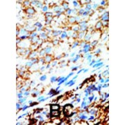 Nucleoside Diphosphate Kinase, Mitochondrial (NME4) Antibody