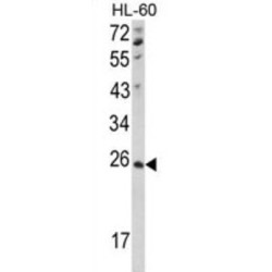 Nucleoside Diphosphate Kinase, Mitochondrial (NME4) Antibody