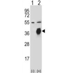 Urokinase Plasminogen Activator Surface Receptor / uPAR / CD87 (PLAUR) Antibody