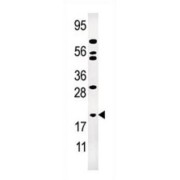 Adenylate Kinase 1 (AK1) Antibody