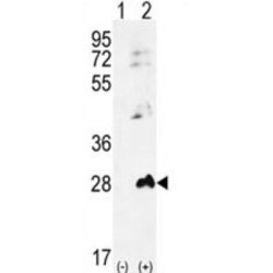 Adenylate Kinase 1 (AK1) Antibody