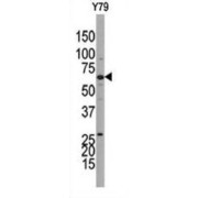 Guanylyl Cyclase beta 1 Antibody