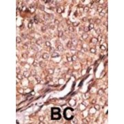 Brain-Specific Angiogenesis Inhibitor 1-Associated Protein 2 (BAIAP2) Antibody