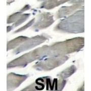 Phosphatidylinositol 4,5-Bisphosphate 3-Kinase Catalytic Subunit Gamma Isoform (PI3KCG) Antibody