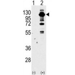 Phosphatidylinositol 4,5-Bisphosphate 3-Kinase Catalytic Subunit Gamma Isoform (PI3KCG) Antibody