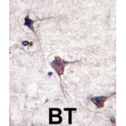 PCPTP1 Antibody