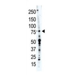 PCPTP1 Antibody