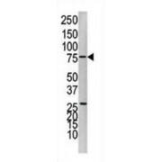 protein Tyrosine Phosphatase 1B (PTP1B) Antibody