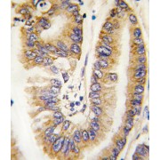 Phosphatidylinositol-3,4,5-Trisphosphate 3-Phosphatase And Dual-Specificity Protein Phosphatase PTEN (PTEN) Antibody