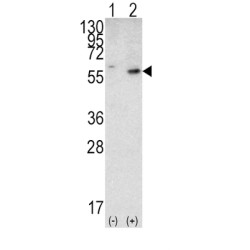 Phosphatidylinositol-3,4,5-Trisphosphate 3-Phosphatase And Dual-Specificity Protein Phosphatase PTEN (PTEN) Antibody