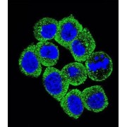 Phosphatidylinositol-3,4,5-Trisphosphate 3-Phosphatase And Dual-Specificity Protein Phosphatase PTEN (PTEN) Antibody