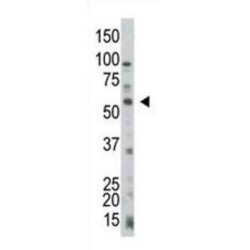 Phosphatidylinositol-3,4,5-Trisphosphate 3-Phosphatase And Dual-Specificity Protein Phosphatase PTEN (PTEN) Antibody