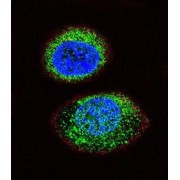 Phosphatidylinositol-3,4,5-Trisphosphate 3-Phosphatase And Dual-Specificity Protein Phosphatase PTEN (PTEN) Antibody