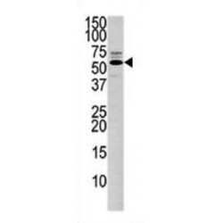 Phosphatidylinositol-3,4,5-Trisphosphate 3-Phosphatase And Dual-Specificity Protein Phosphatase PTEN (PTEN) Antibody