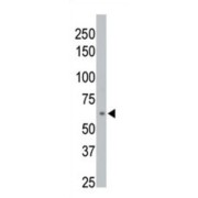 Protein Phosphatase, Mg2+/Mn2+ Dependent 1D (PPM1D) Antibody