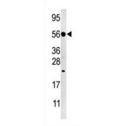 Dual Specificity Phosphatase 8 (DUSP8) Antibody