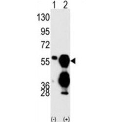 Protein Phosphatase, Mg2+/Mn2+ Dependent 1F (PPM1F) Antibody