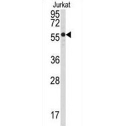 Protein Phosphatase 3 Catalytic Subunit Beta (PPP3CB) Antibody