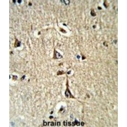 Glycerol-3-Phosphate Dehydrogenase 1 (GPD1) Antibody