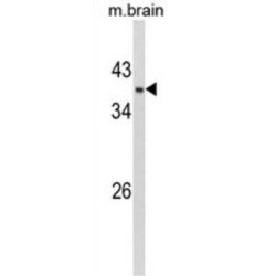 Glycerol-3-Phosphate Dehydrogenase 1 (GPD1) Antibody