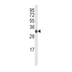 Myeloid Differentiation Primary Response Protein MyD88 (MYD88) Antibody