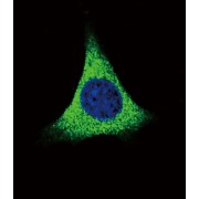 Thrombospondin 1 (THBS1) Antibody