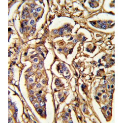 Thrombospondin 1 (THBS1) Antibody