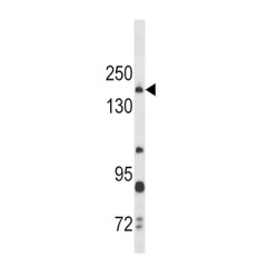 Thrombospondin 1 (THBS1) Antibody