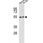 Oxysterols Receptor LXR-Beta (NR1H2) Antibody