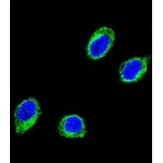 Coiled-Coil Alpha-Helical Rod Protein 1 (CCHCR1) Antibody