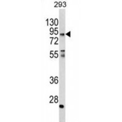 Coiled-Coil Alpha-Helical Rod Protein 1 (CCHCR1) Antibody