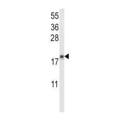 Natriuretic Peptides A (NPPA) Antibody