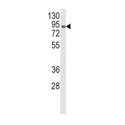 Membrane Primary Amine Oxidase (AOC3) Antibody