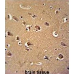 Calmodulin 1 (CALM1) Antibody