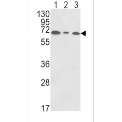 Polymeric Immunoglobulin Receptor (PIGR) Antibody