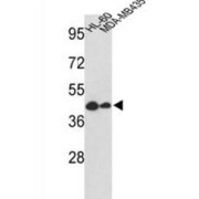 Gasdermin B (GSDMB) Antibody