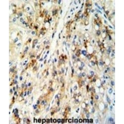 Cat Eye Syndrome Critical Region Protein 5 (CECR5) Antibody