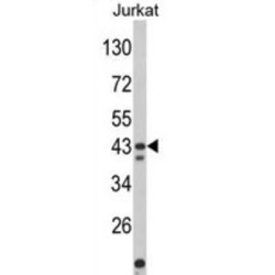 Cat Eye Syndrome Critical Region Protein 5 (CECR5) Antibody