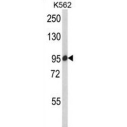 Sterol Regulatory Element-Binding Protein Cleavage-Activating Protein (SCAP) Antibody