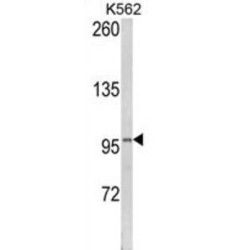 Lipin 2 (LPIN2) Antibody