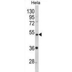 Protein Phosphatase 2 Regulatory Subunit Bbeta (PPP2R2B) Antibody