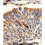 Vesicle Transport Through Interaction With T-SNAREs Homolog 1A (VTI1A) Antibody