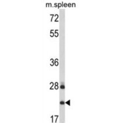 Vesicle Transport Through Interaction With T-SNAREs Homolog 1A (VTI1A) Antibody