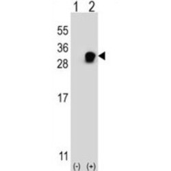 Vesicle Transport Through Interaction With T-SNAREs Homolog 1A (VTI1A) Antibody