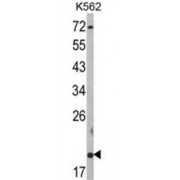 Ring Finger Protein 5 (RNF5) Antibody