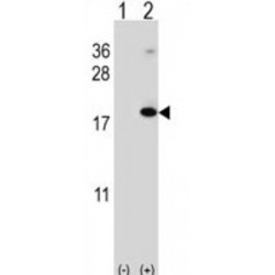 Ring Finger Protein 5 (RNF5) Antibody