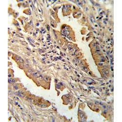 Interleukin 8 / IL8 (CXCL8) Antibody