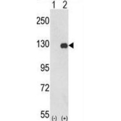 Protein Tyrosine Kinase 2 Beta (PTK2) Antibody