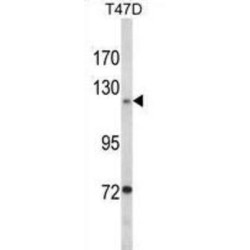 Protein Tyrosine Kinase 2 Beta (PTK2) Antibody