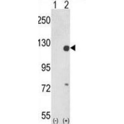 Protein Tyrosine Kinase 2 Beta (PTK2) Antibody